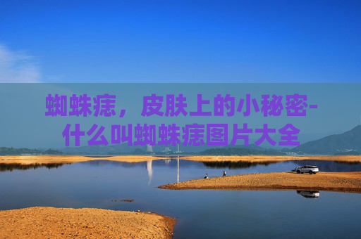 蜘蛛痣,皮肤上的小秘密-什么叫蜘蛛痣图片大全 蜘蛛痣,皮肤上的小秘密-什么叫蜘蛛痣图片大全