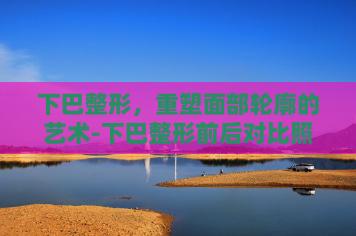 下巴整形，重塑面部轮廓的艺术-下巴整形前后对比照片